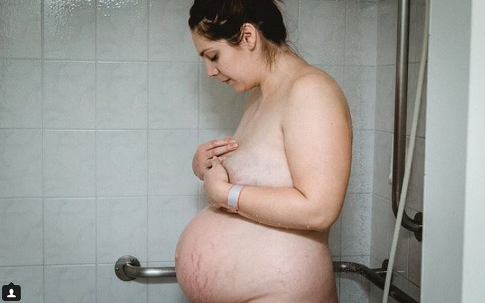 Dieses Foto zeigt, wie der Bauch nach einer Geburt wirklich aussieht